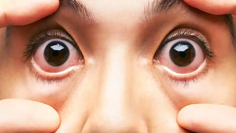 Foto - Microsleep, Jangan Paksa Apabila Kantuk Sudah Terasa